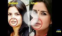 Bollywood Divas And Their Plastic Surgeries | Images